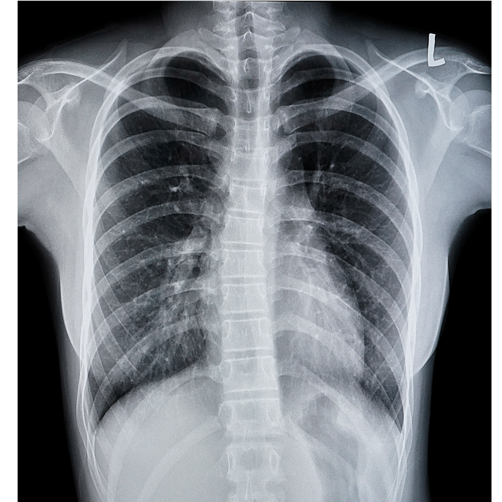 XrayImage