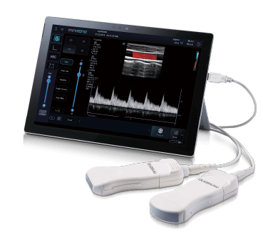 Minisono Portable Tablet Ultrasound